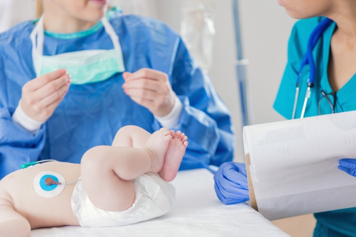 Medical professionals preparing for a newborn frenectomy procedure