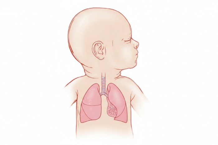 Illustration of infant lungs