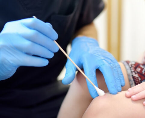 Pediatric provider applying cryotherapy to a wart