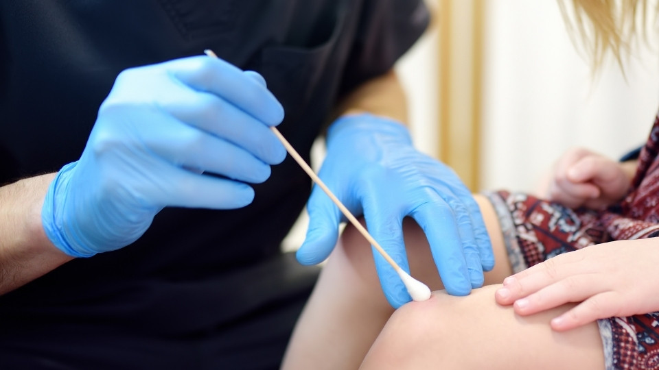 Pediatric provider applying cryotherapy to a wart