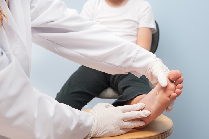 Pediatric provider examining a plantar wart